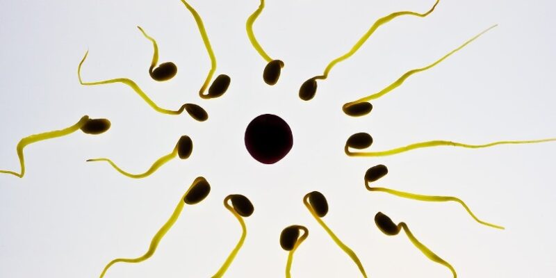 Sperm Abnormalities | Sperm Count, Life Span, and Motility