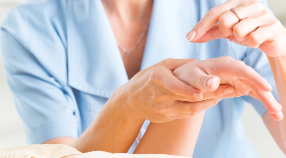 Acupuncture session on the hand