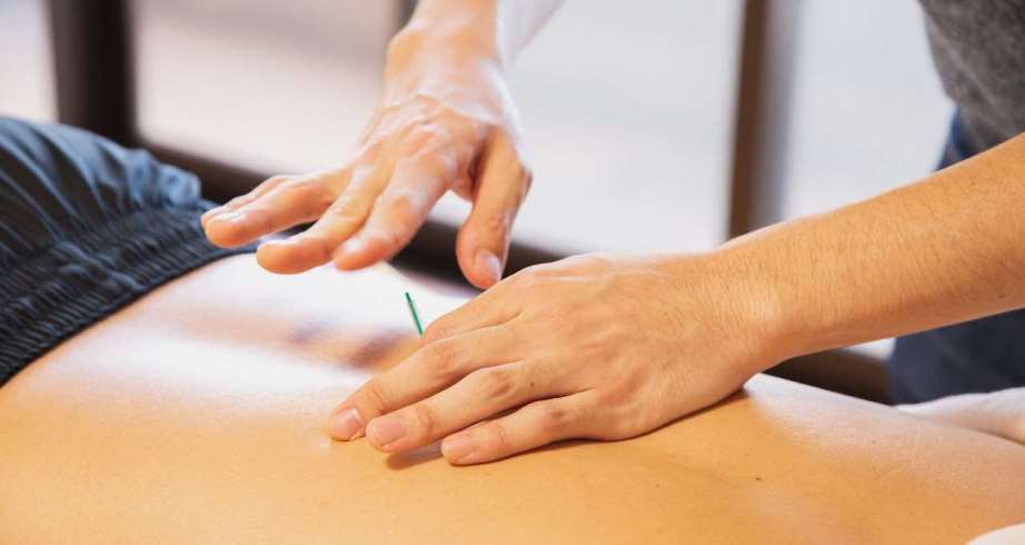 Acupuncture treatment