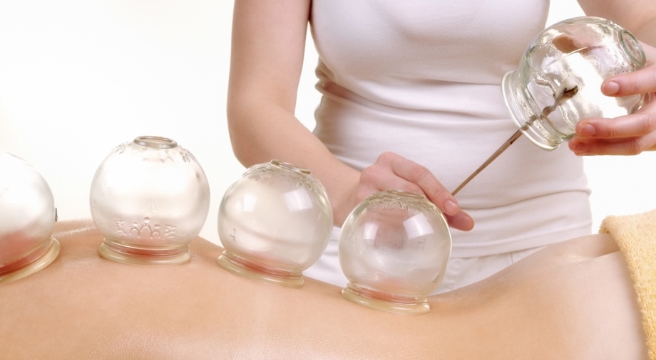 What Is Cupping Therapy?